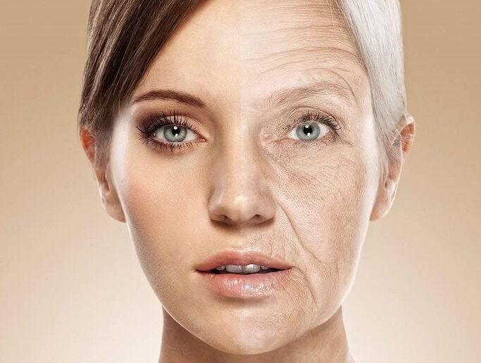 Lazerle gençleştirme öncesi ve sonrası yüz cildi